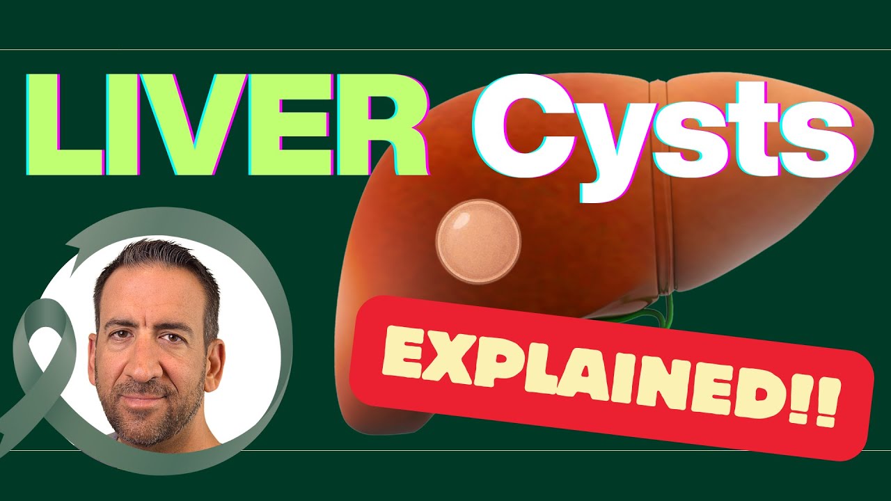Liver Cysts EXPLAINED: Simple and Complex Cysts - What to do?