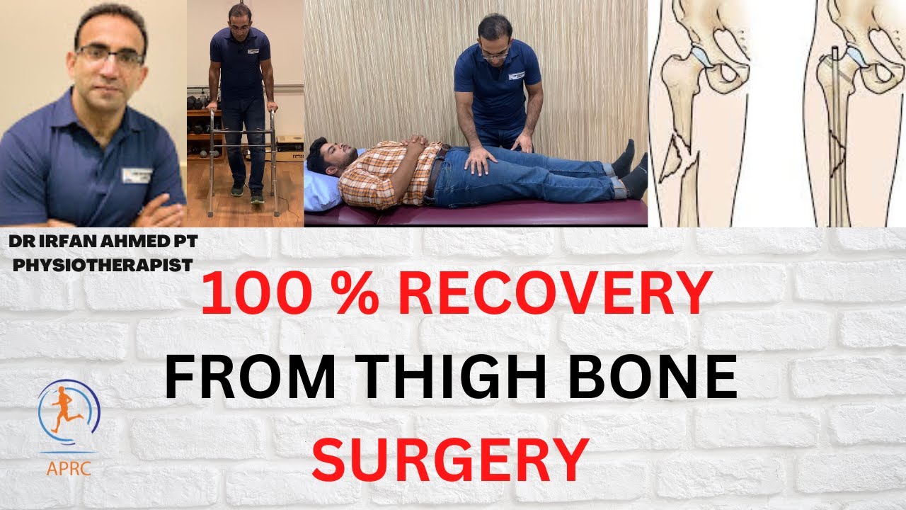 Learn Everything  About Rehabilitation, Exercises and Recovery For thigh bone fracture|Urdu |Hindi