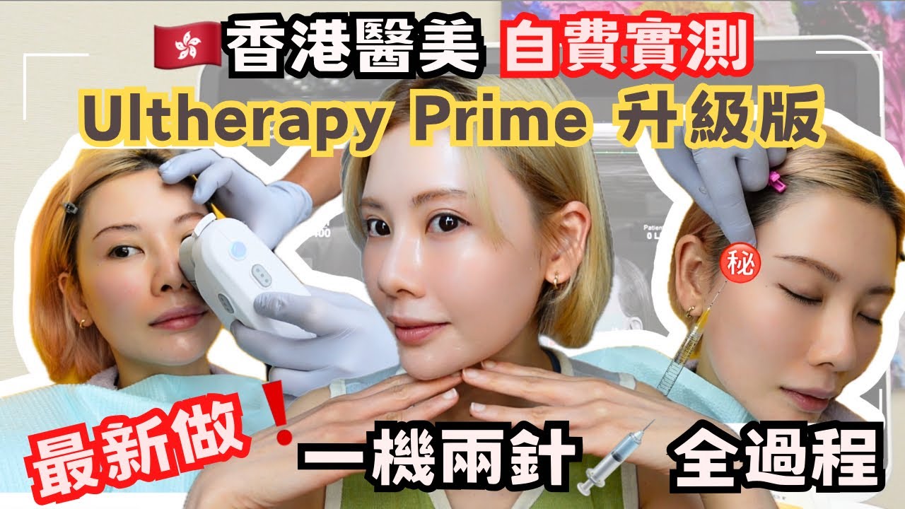 【💉🇭🇰香港醫美 自然變美㊙️】全自費💸最新機❗️Ultherapy Prime實測🤩新、舊版比較❓｜最近做的三項醫美👉🏻一機兩針💉 全過程｜保濕針我選定它🔥｜🙊偷偷告訴你：醫美減法你要懂🩷