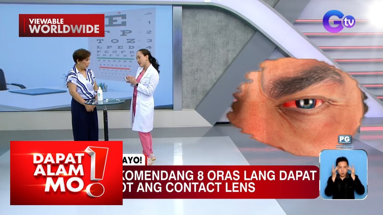 Epekto ng matagal na pagsuot ng contact lens sa mata, alamin | Dapat Alam Mo!