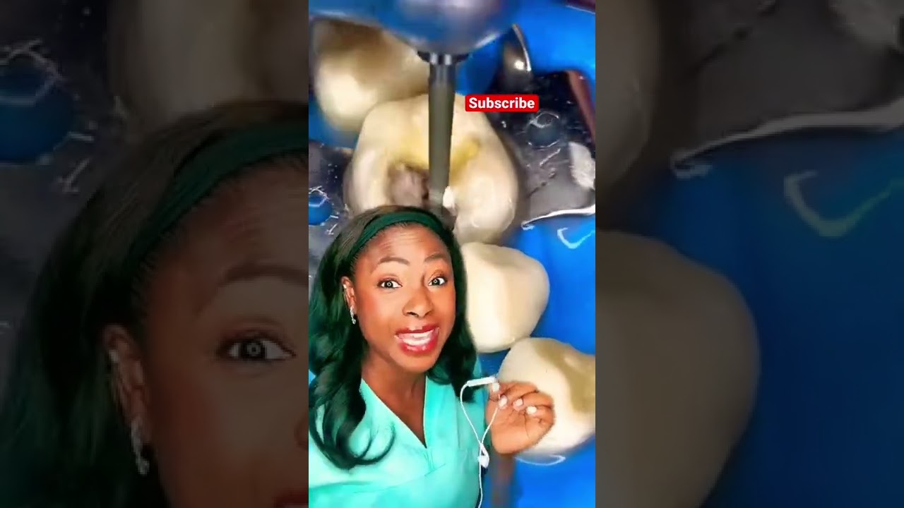 Big cavity 