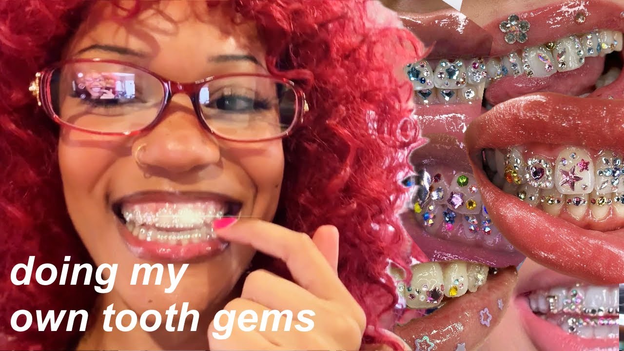 MAKING MY OWN GRILLZ (W/ TOOTH GEMS) ✨🪩💎