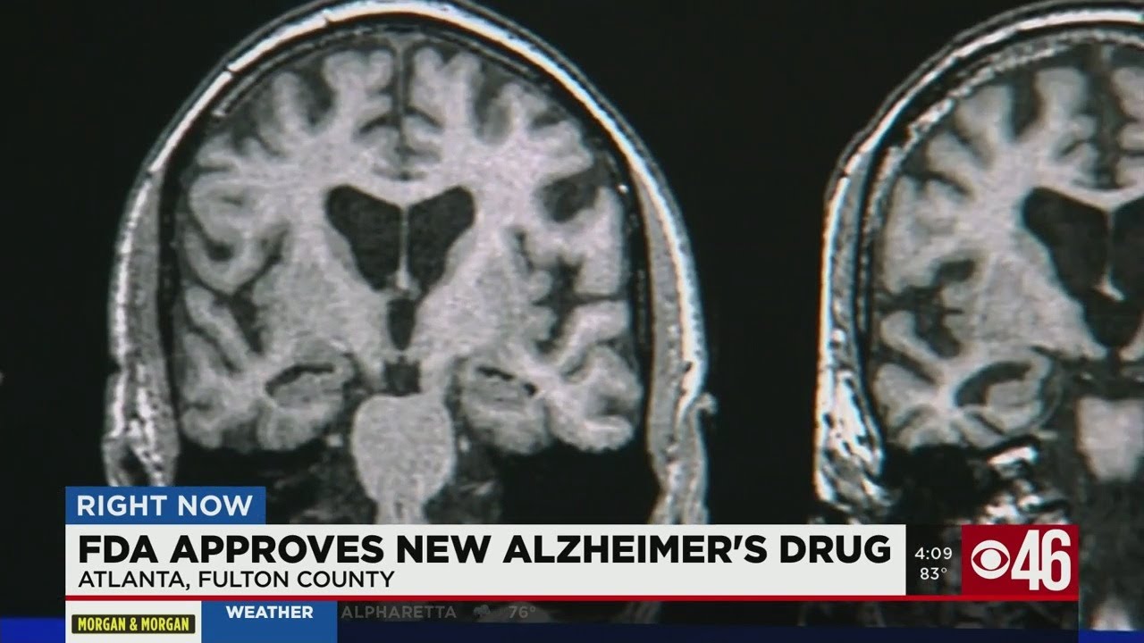 FDA approves new Alzheimer's drug