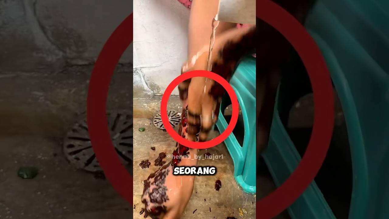 Wanita Ini Punya Serangga di Lengannya, dan Tak Ada yang Bisa Menghapusnya&hellip;😱