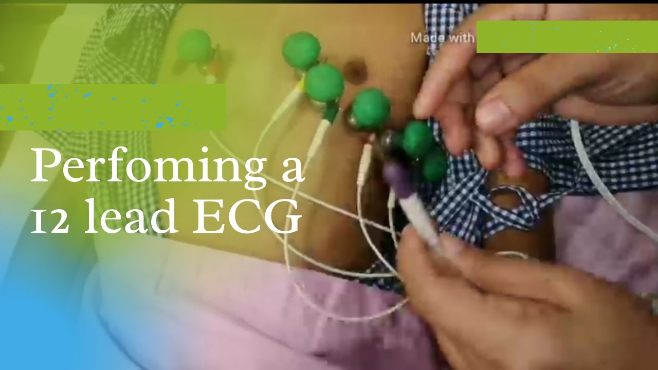 PERFORMING A 12 LEAD ELECTROCARDIOGRAM (ECG)