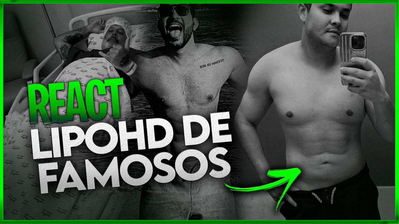 Lipo HD Masculina Antes e Depois