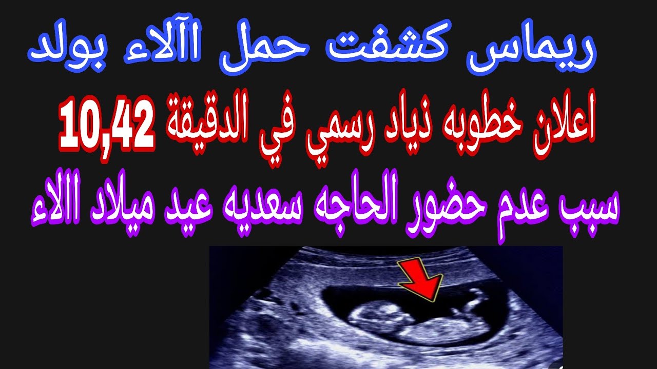 عاجل 💥ريماس كشفت حمل آلاء في ولد🤰إعلان خطوبه ذياد في الدقيقة 10,42💃 أخطاء عيد الميلاد 