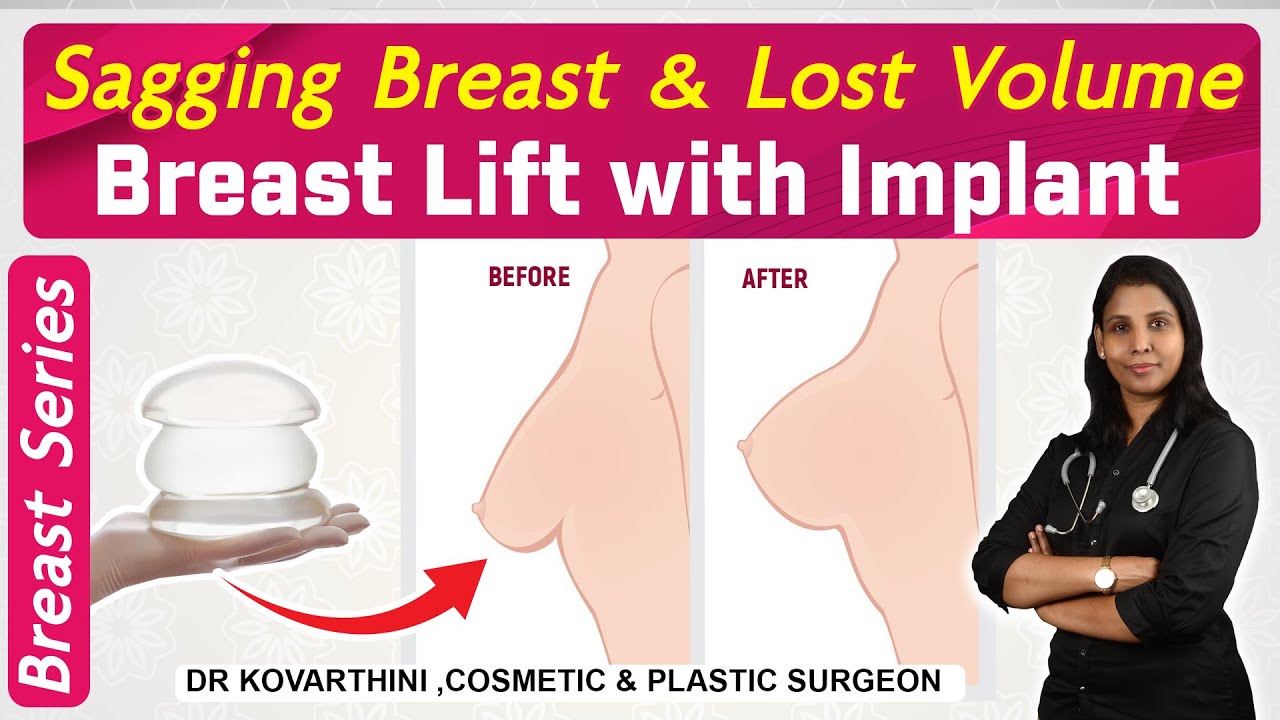 Sagging Breast Lift with breast implant | Breast Series | Dr. Kovarthini