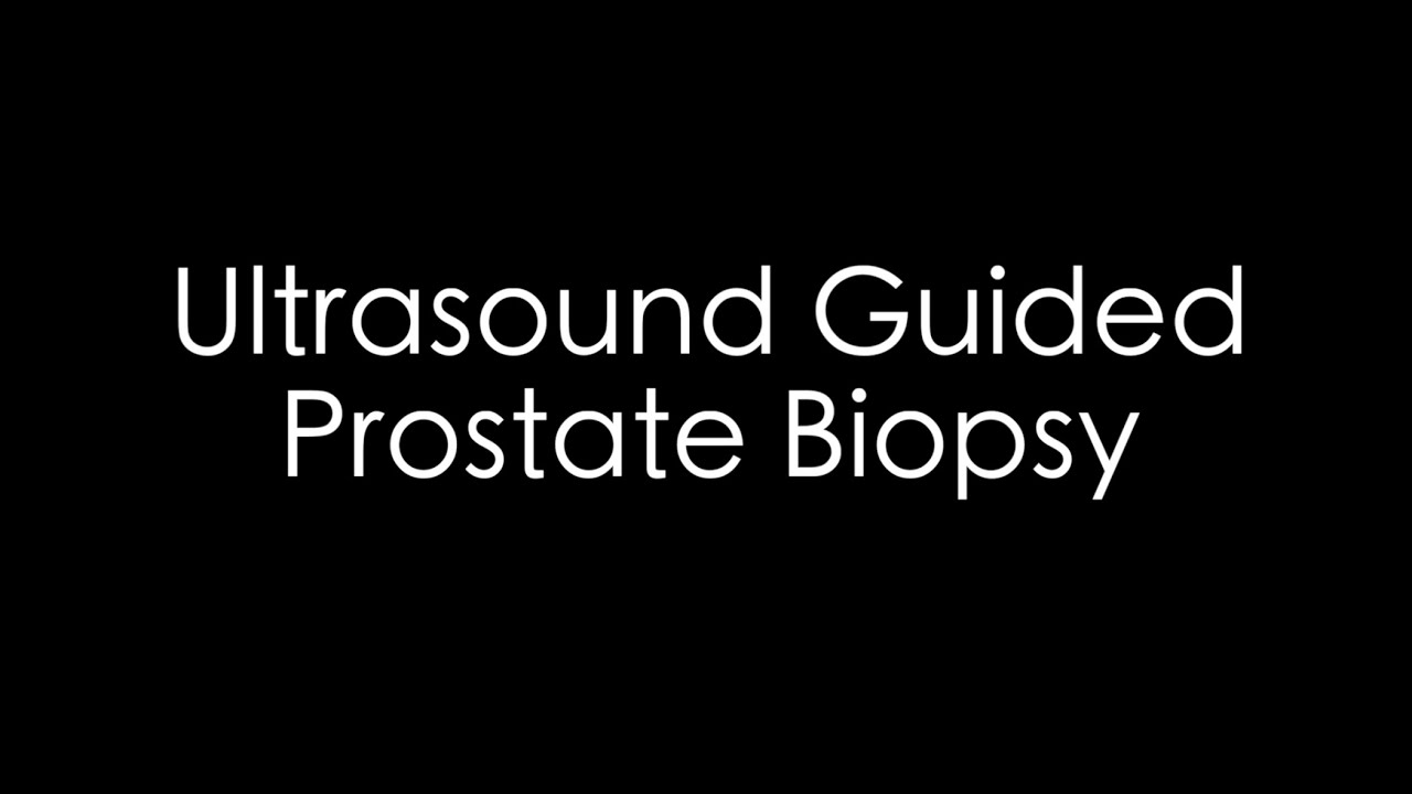 Ultrasound Guided Prostate Biopsy