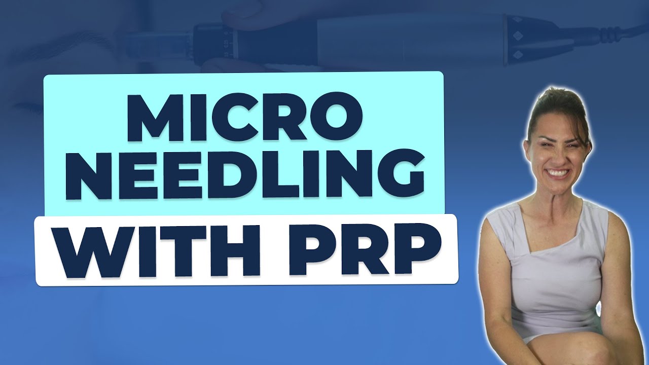 Microneedling with PRP | Platelet Rich Plasma Facial Benefits