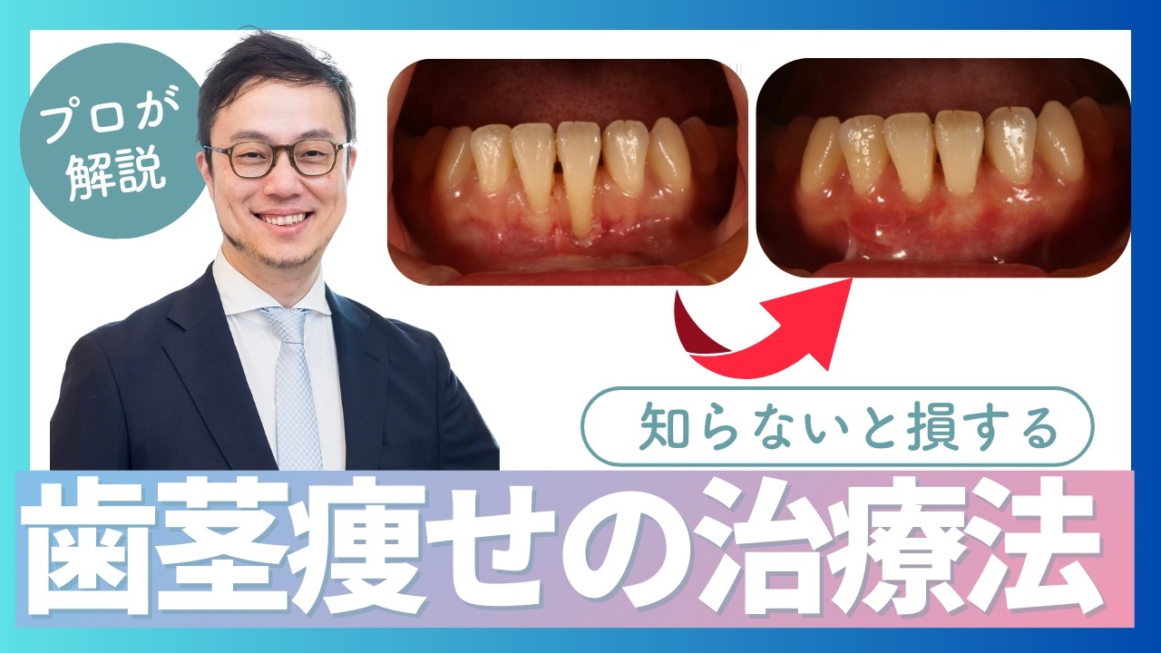 【NY大卒歯科医師が解説】歯茎下がりの治療法、矯正治療との関係性は？