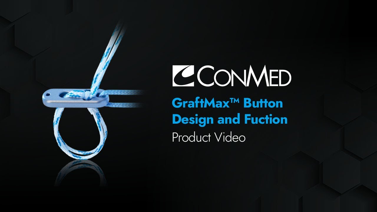 Design and Function of the GraftMax&trade; Button - CONMED Animation