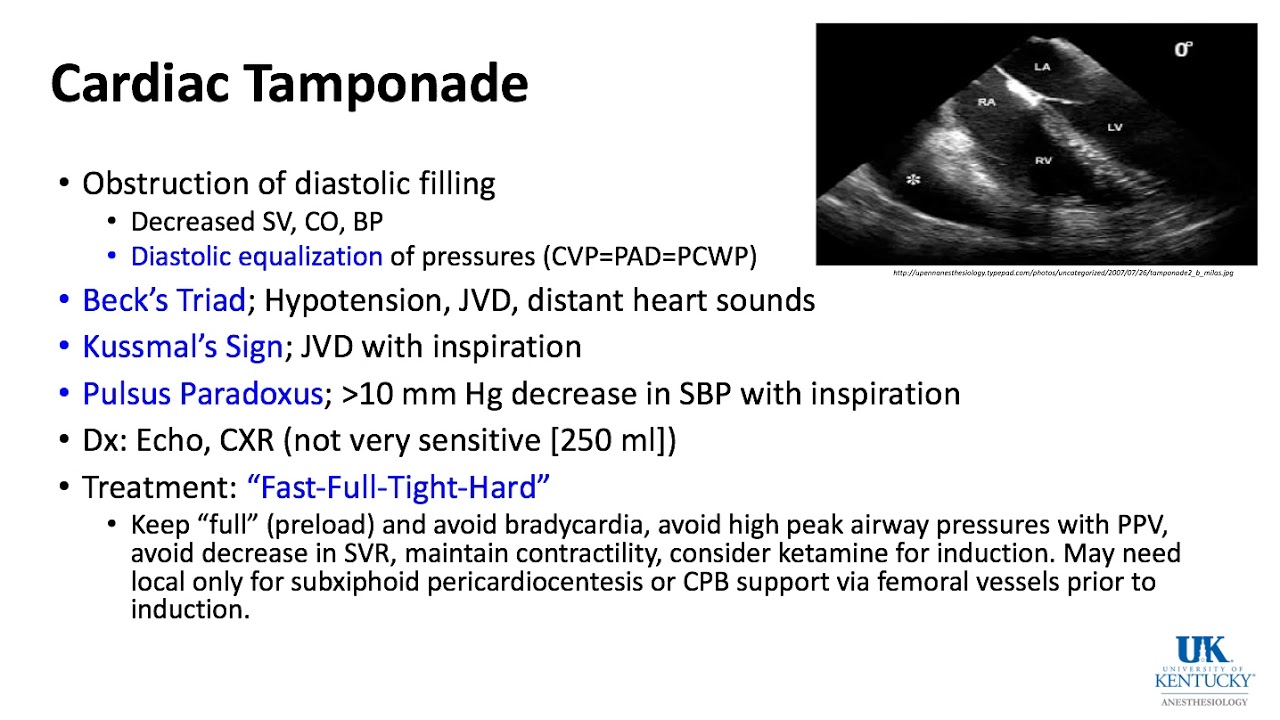University of Kentucky Cardiac KeyWord Review Part 3 of 3 - (Dr. Schell)