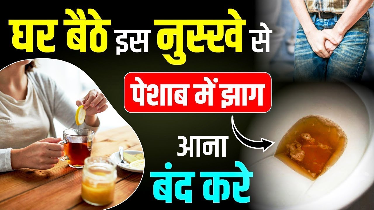 🚽 पेशाब में झाग आना बंद करें🚫🌱| Peshab me Jhaag | Proteinuria Treatment in Ayurveda | KRM Ayurveda