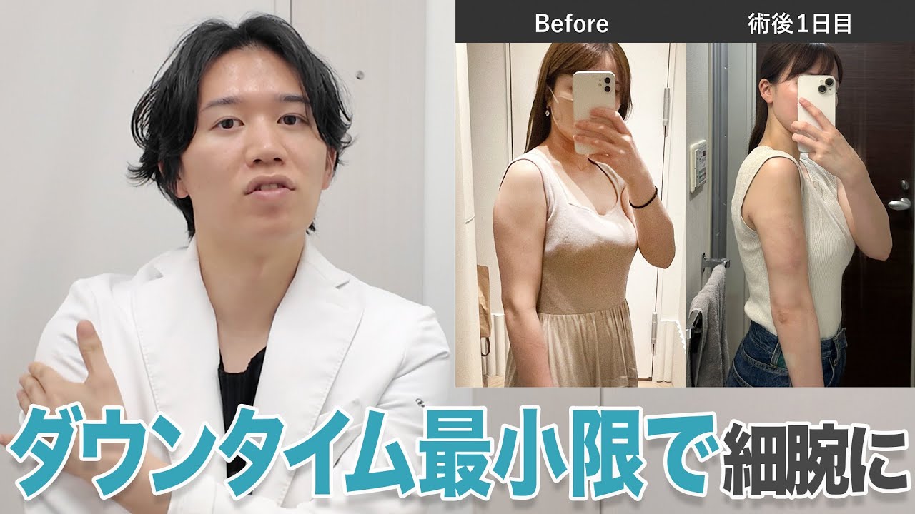 【振袖・背中スッキリ】二の腕脂肪吸引注射がリニューアルしました