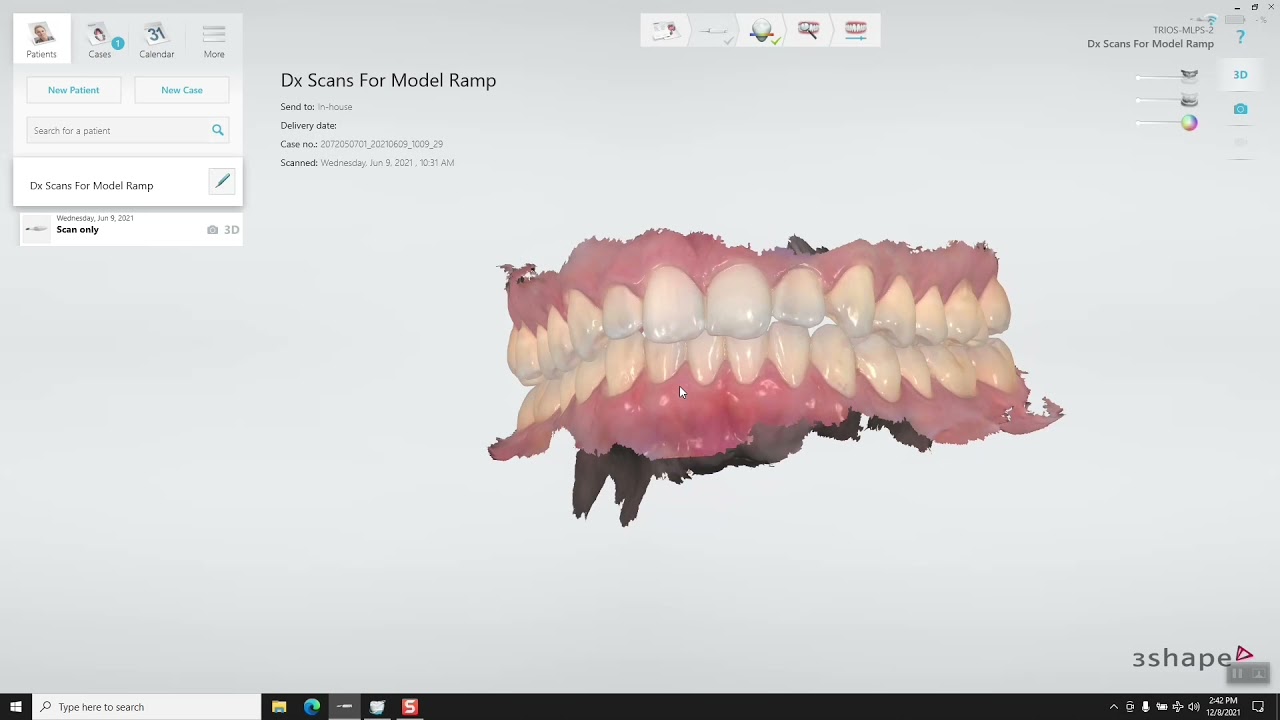 Making a Model from a Trios Scan for 3D Printing