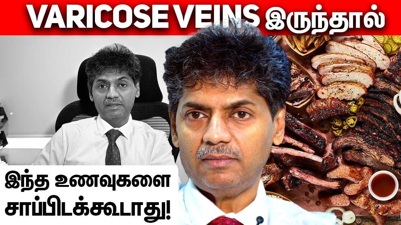 Varicose Veins இருந்தால் இந்த உணவுகளை சாப்பிடக்கூடாது! | Dr Bala Kumar