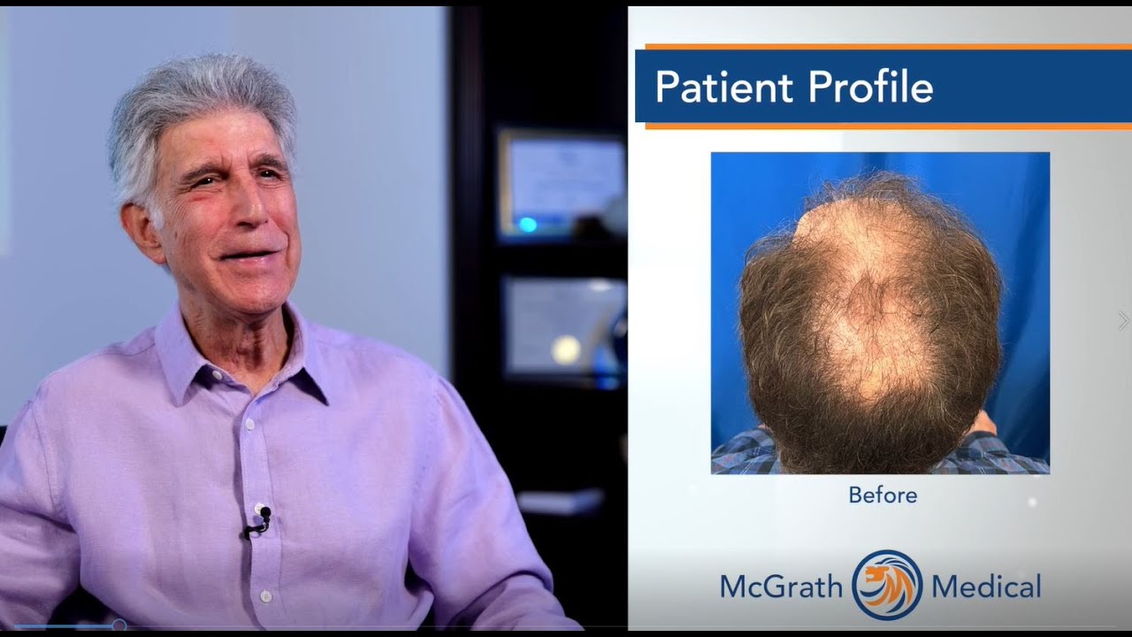Age should not be a factor in having a hair transplant - Austin, Texas