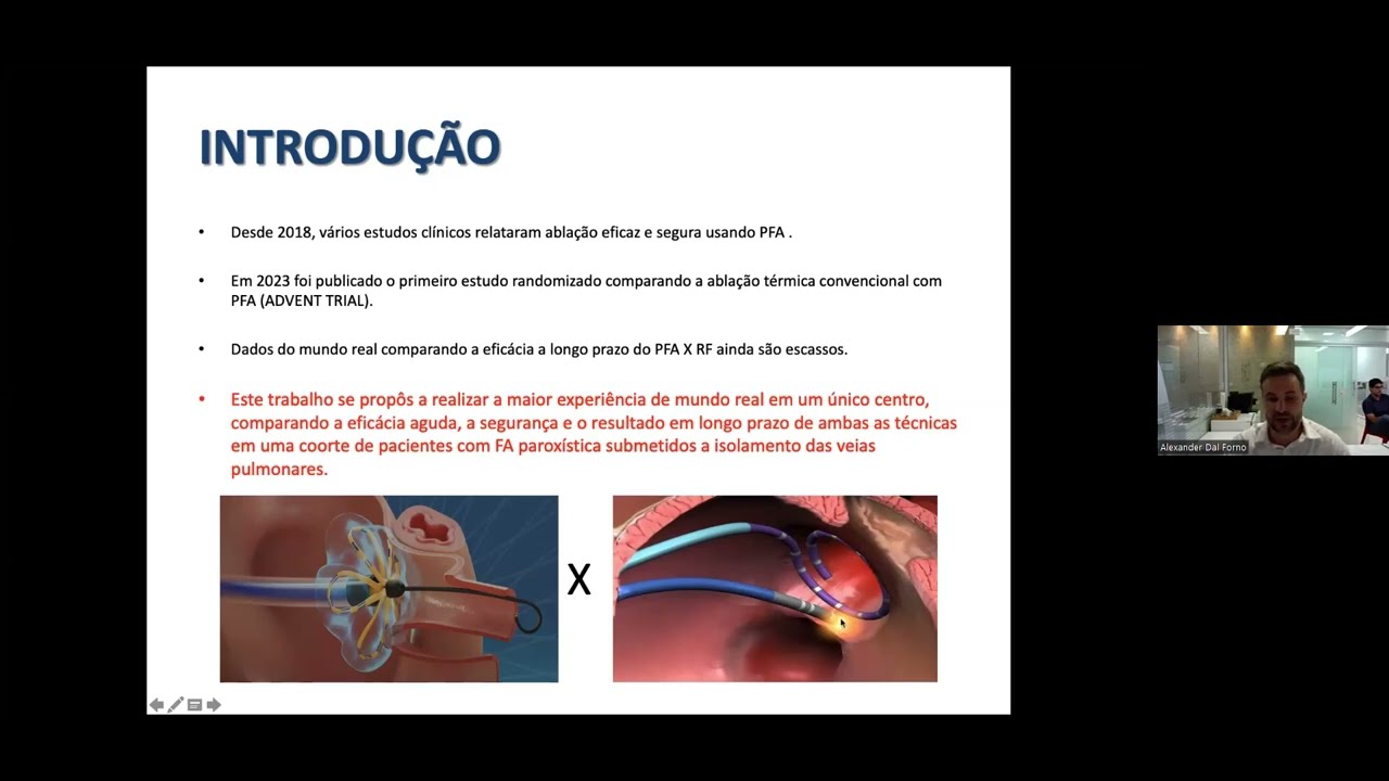 Ablação por campo pulsado Vrs Ablação por radiofrequencia  em pacientes com Fibrilação Atrial