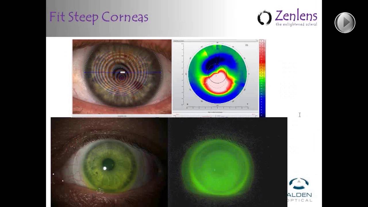 Zenlens Introductory Webinar 20140903