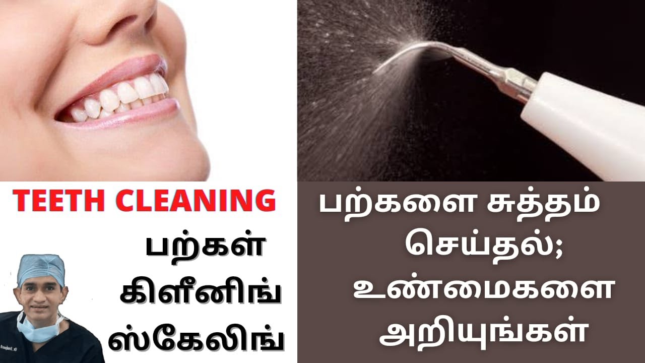 பற்கள் கிளீனிங் ஸ்கேலிங்(Scaling/Teeth Cleaning) செய்தல | உண்மைகளை அறியுங்கள் | Dr Arunkumar Chennai