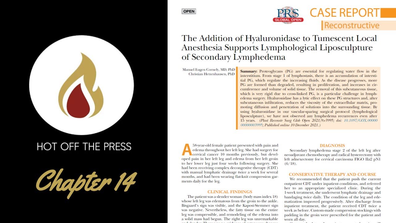 HOTP Chapter14 The Addition of Hyaluronidase to Tumescent Local Anesthesia