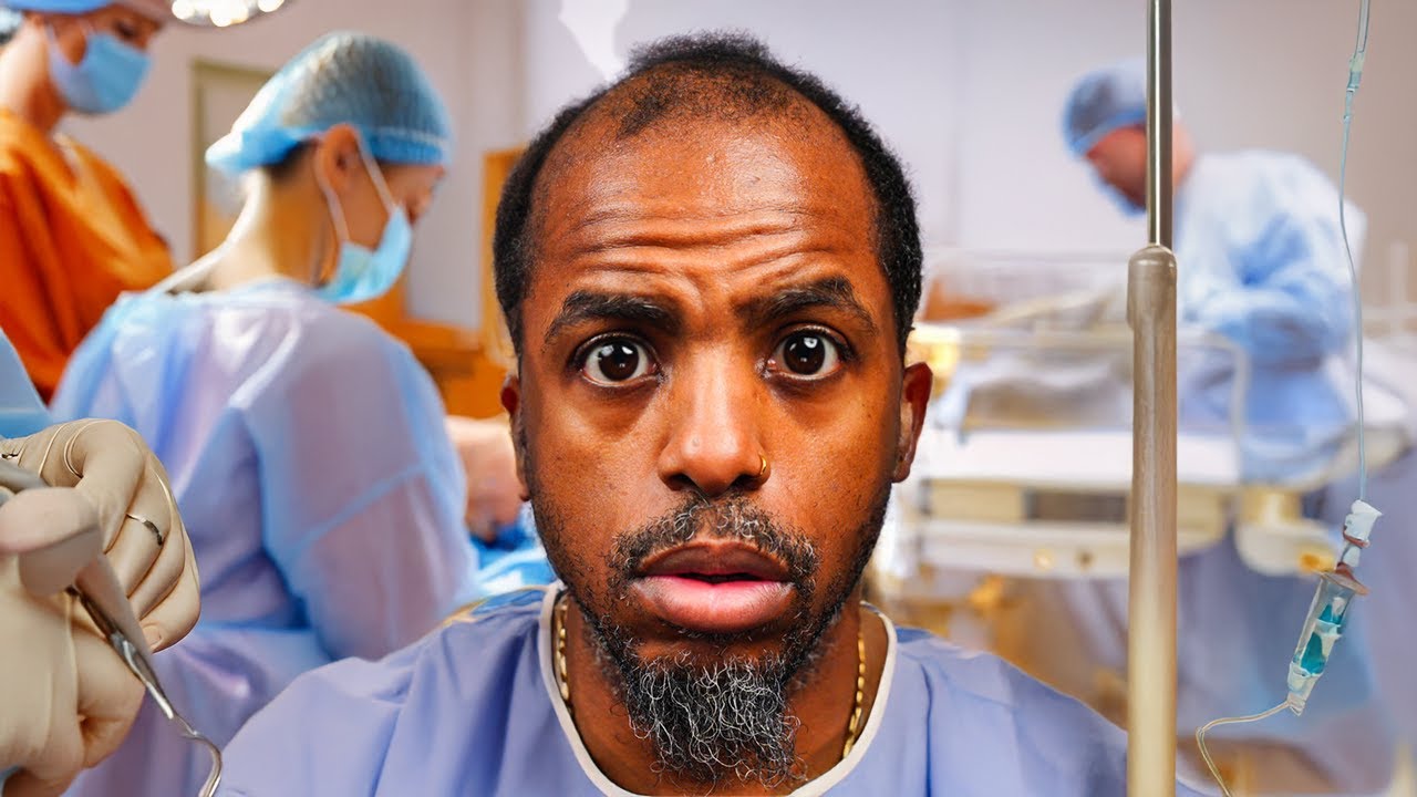 Barber Gets a Hair Transplant – The Shocking Truth & First Look!