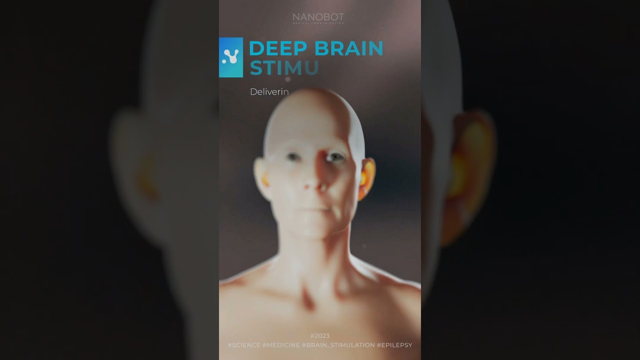 Deep Brain Stimulation