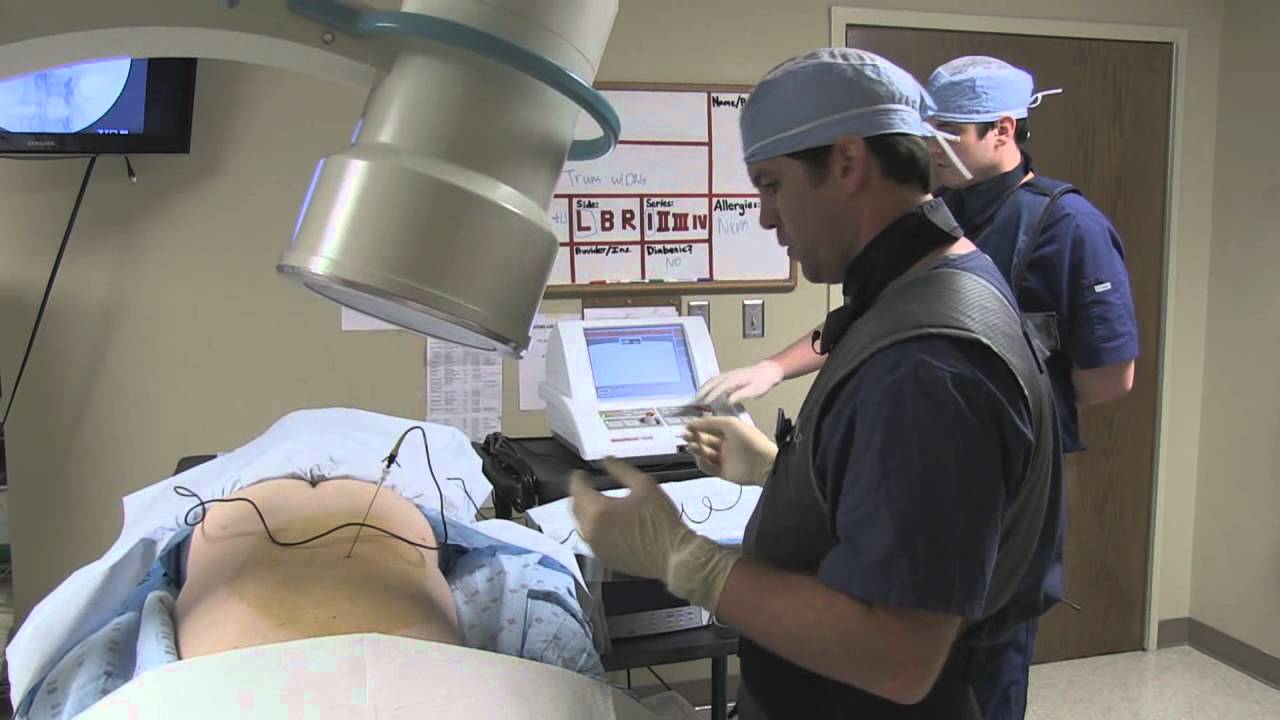 Transforaminal epidural with Dorsal Root Ganglion Pulsed Radiofrequency.wmv