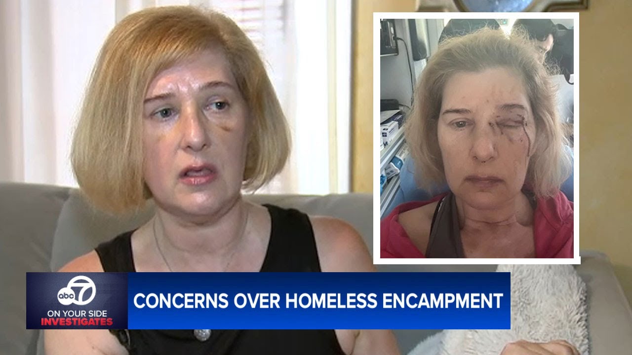 Woman viciously attacked by homeless man in LA - 7 On Your Side Investigates