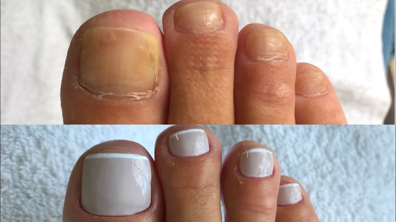 Pedicure - Transformação!!!