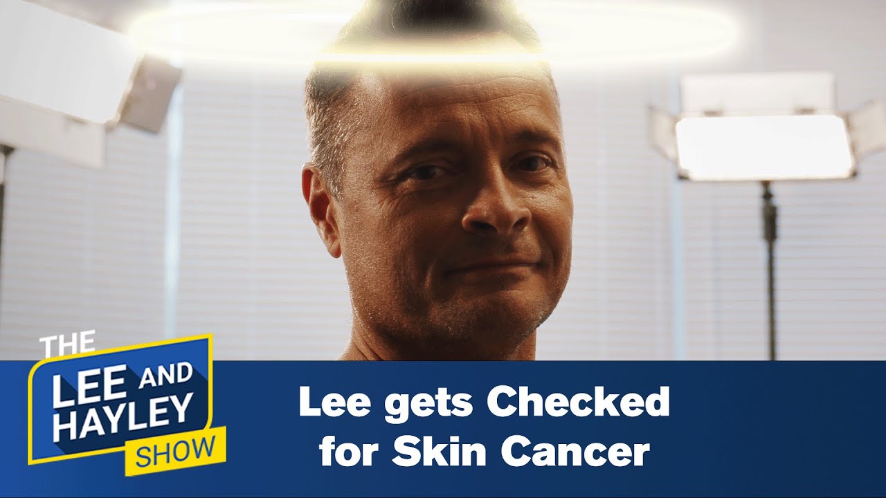 Lee gets Checked for Skin Cancer | The Lee and Hayley Show