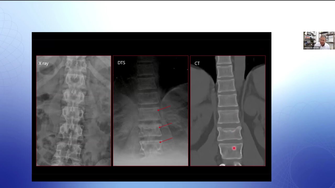 Clinical Innovation: The role of Nanox.ARC in supporting modern imaging workflows