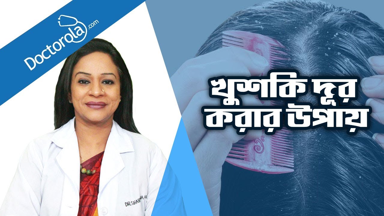 খুশকি দূর করার সহজ উপায় । স্থায়ীভাবে খুশকি দূর করুন । Ways to get rid of Dandruff Easily