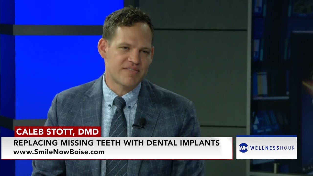 The Cost of Dental Implants in Boise, ID