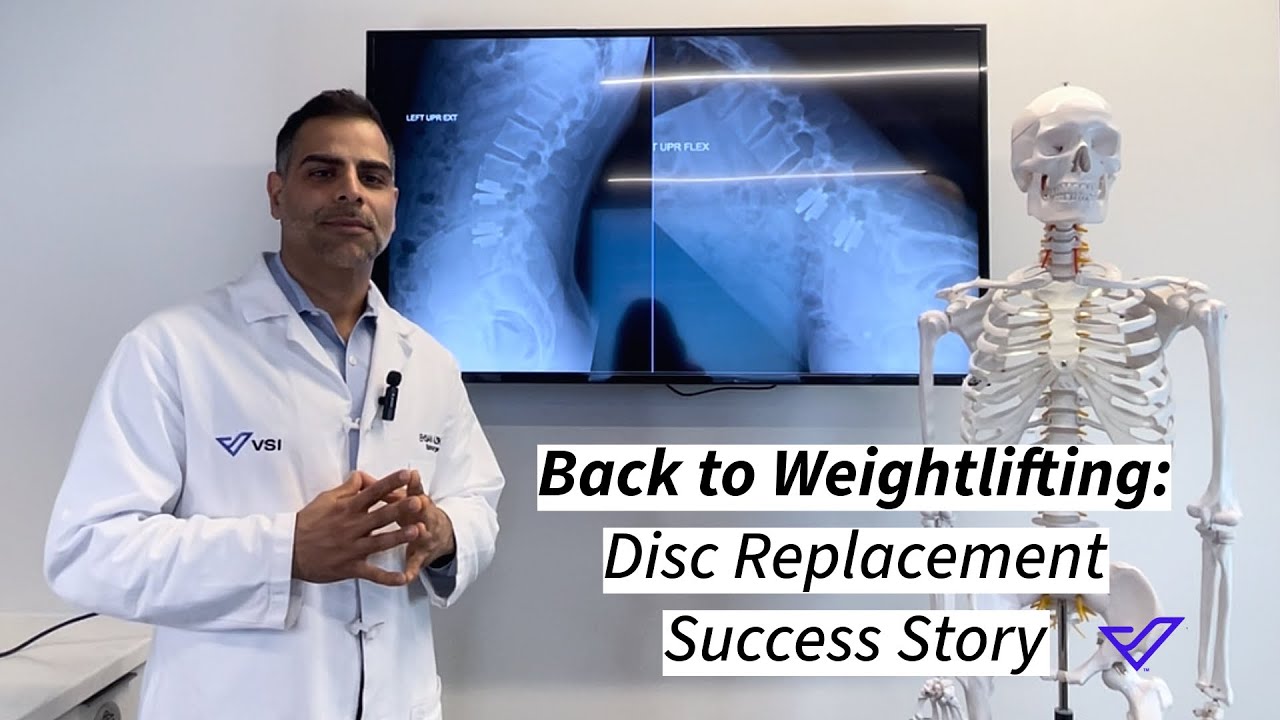 Back to Weightlifting: Disc Replacement Success Story