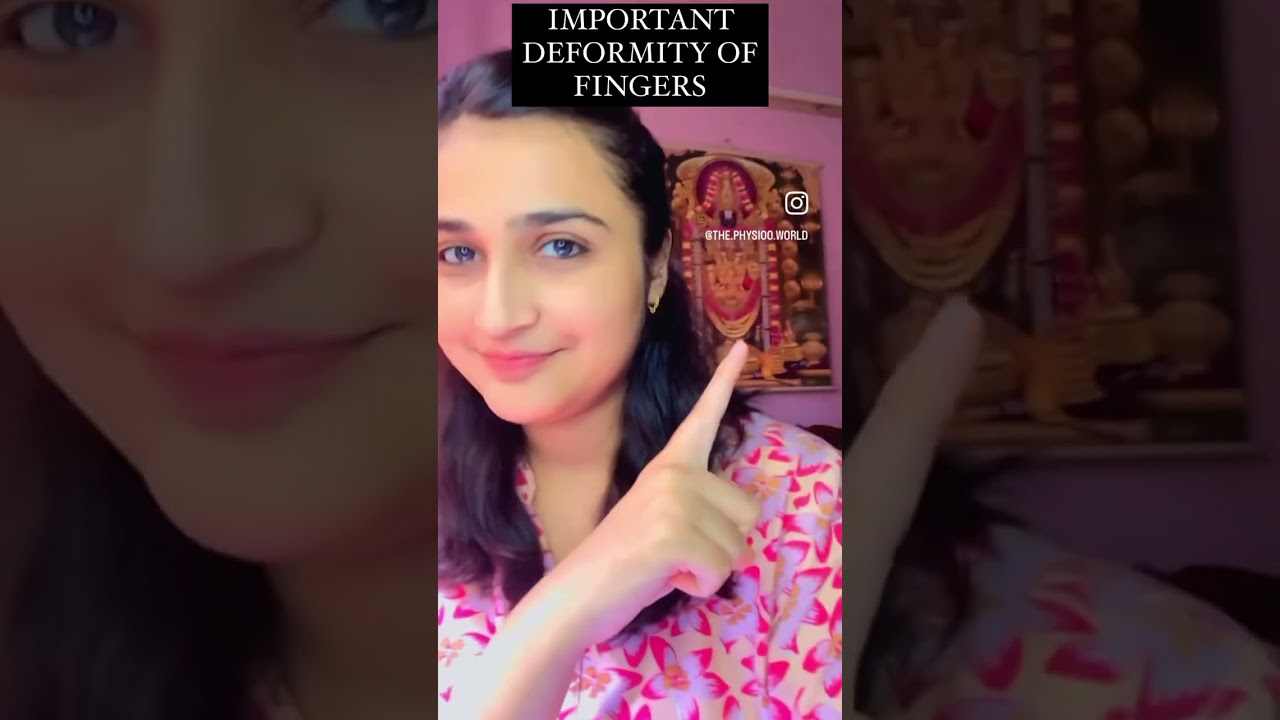 DEFORMITY OF FINGERS.