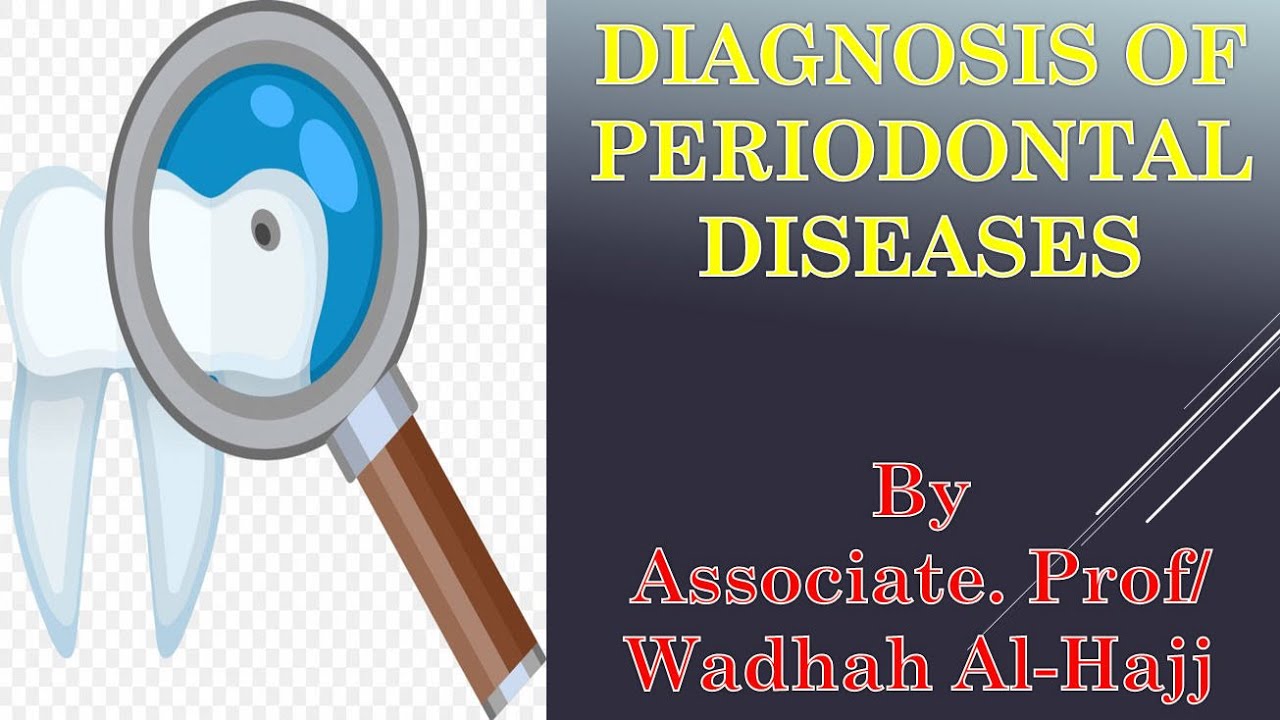 23- Diagnosis of periodontal diseases - Dr Wadhah Periodontology lectures.  د/ وضاح الحاج
