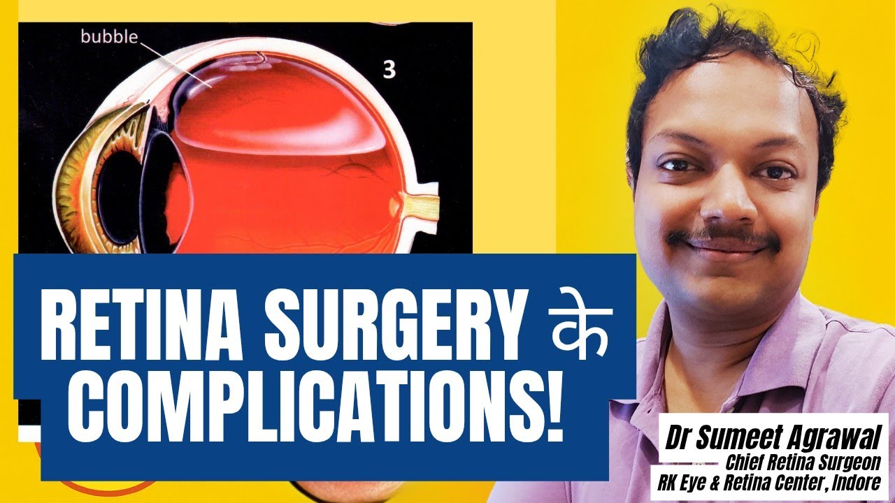 Retina Surgery के Side Effects? सच और समाधान | Dr. Sumeet Agrawal | Safe or Risky ? 