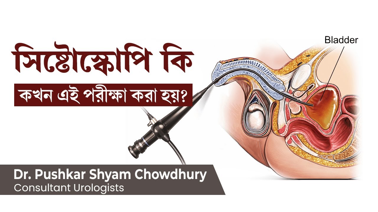 সিস্টোস্কোপি কি, এই পরীক্ষা কখন করা হয় | What is cystoscopy? why cystoscopy test is used for?