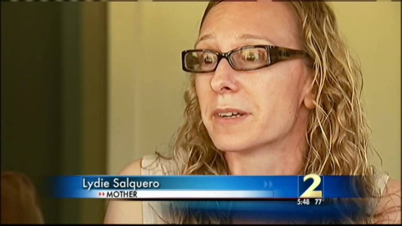 Teen scarred from black henna
