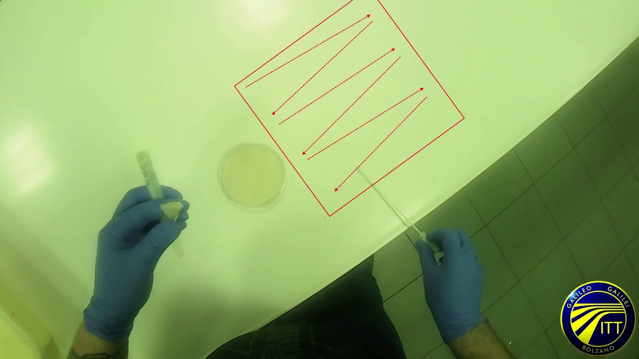Semina per striscio (tampone su superficie) - Corso di microbiologia