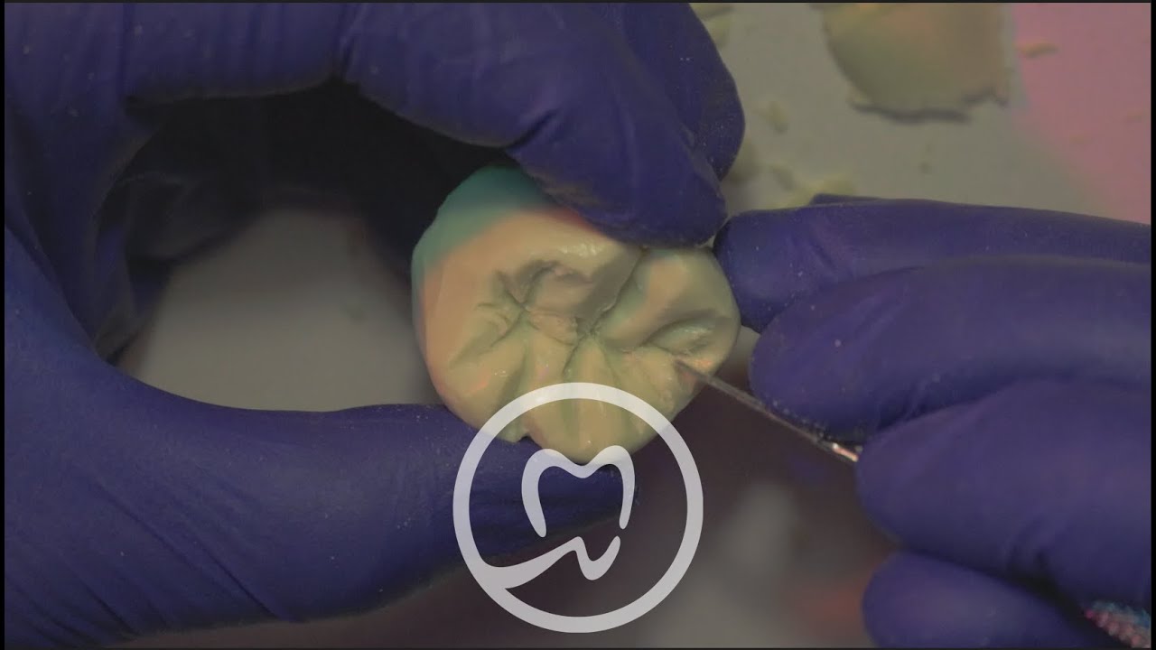 نحت المولر بأدق التفاصيل | Upper First Molar Tooth Carving (Part 2)