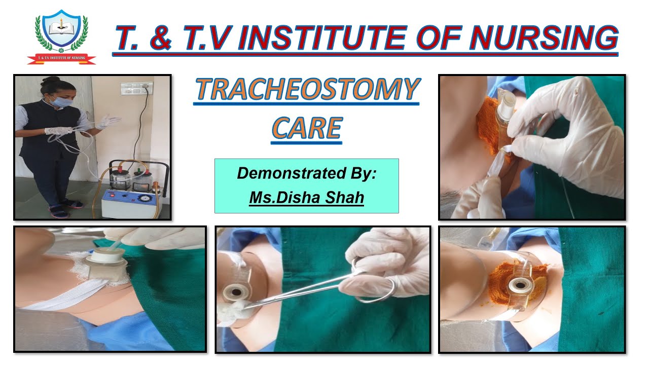 Tracheostomy care