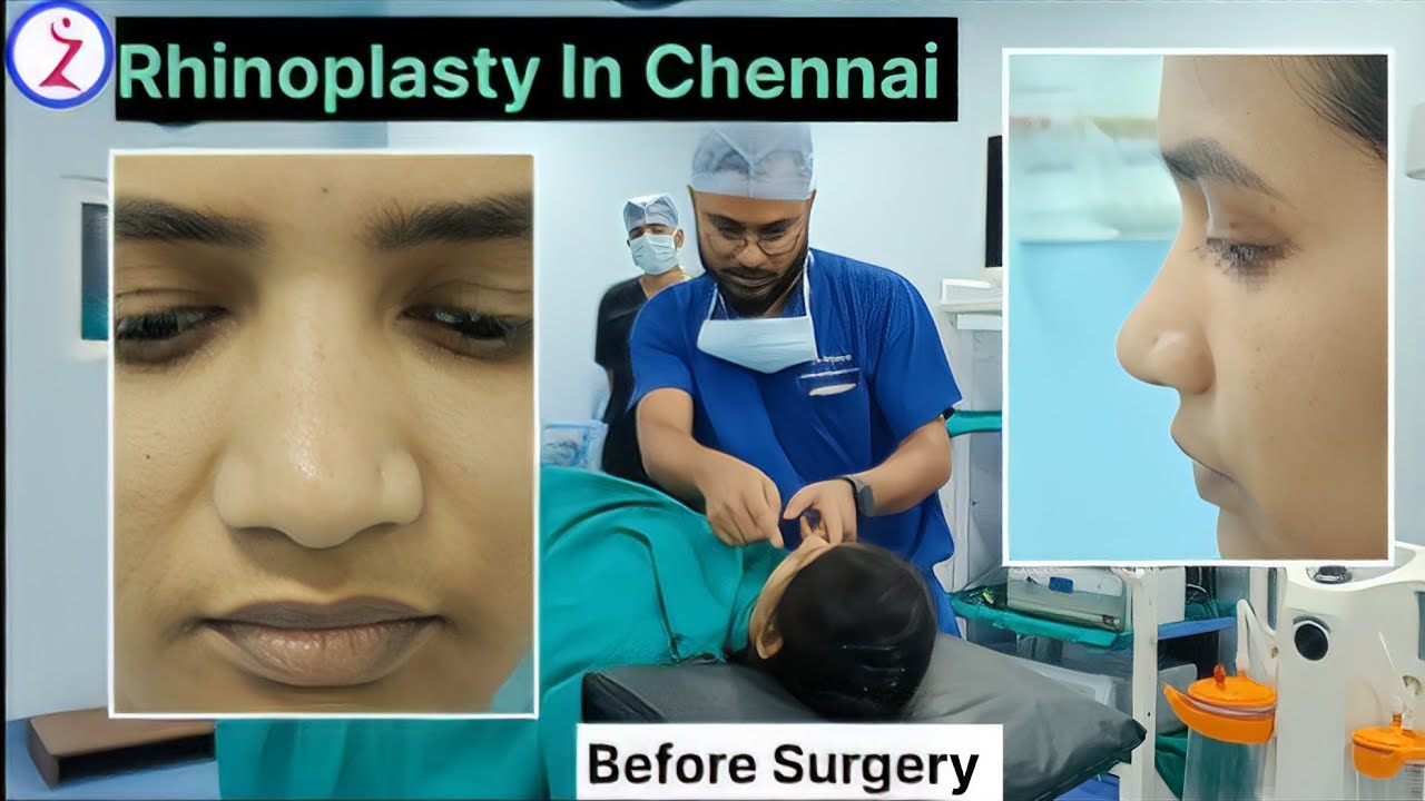 Rhinoplasty In Chennai | Cost Of Rhinoplasty Surgery In Chennai | Zenith Clinic.