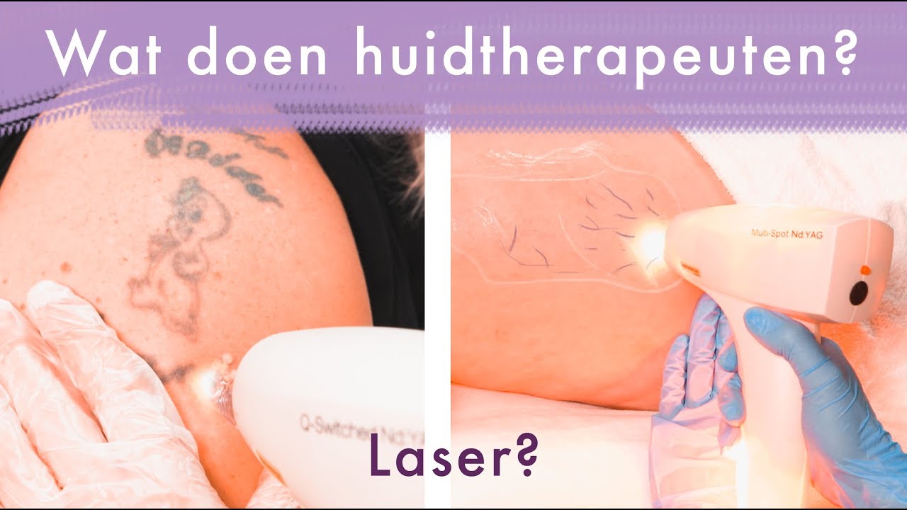 Behandelingen huidtherapie