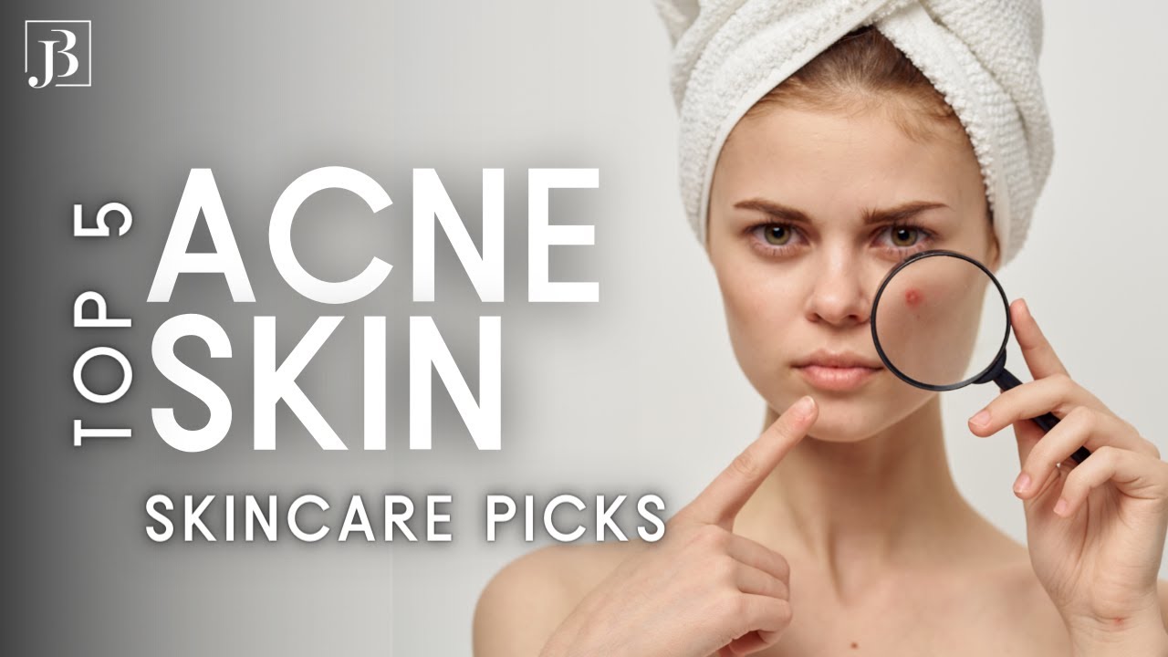 TOP 5 Skincare Products for ACNE-PRONE SKIN | Best Performance, Best Results, Best Price!