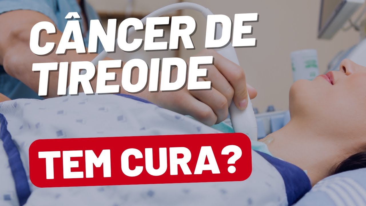 Câncer de tireoide tem cura? Quais as chances?