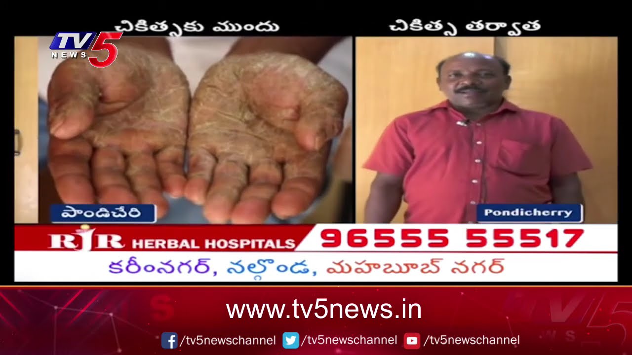 Good Health: RJR Herbal Hospitals | Telangana | Andhra Pradesh| TV5 News Digital