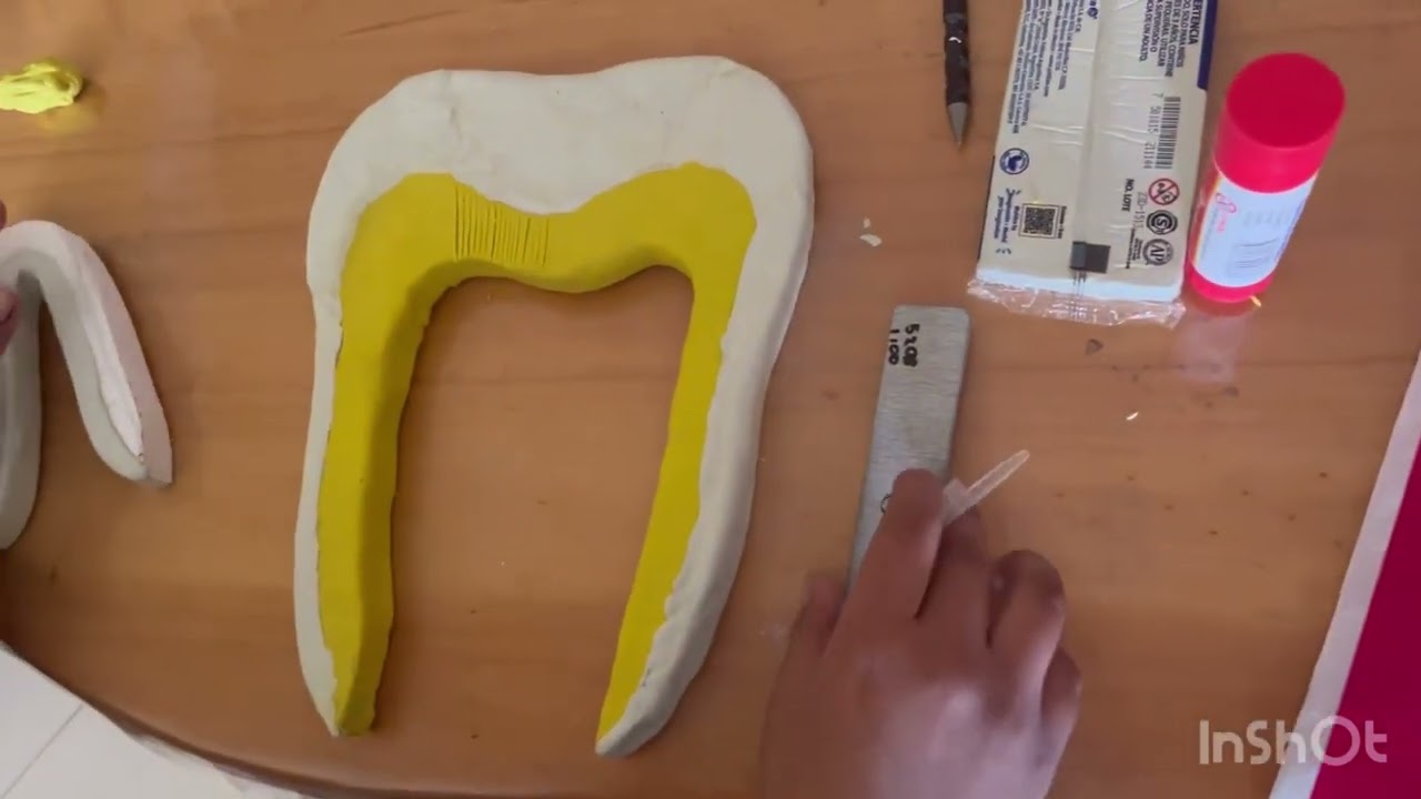 Maqueta de un Diente